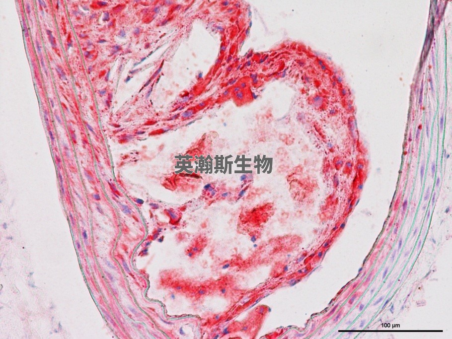 油红O染色.jpg