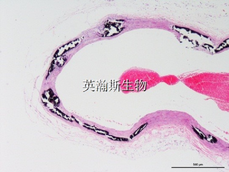 Von Kossa染色_wm.jpg