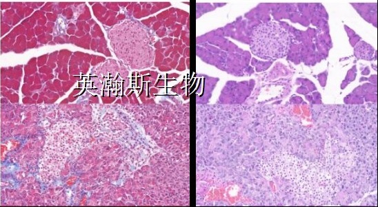 胰腺炎_wm.jpg