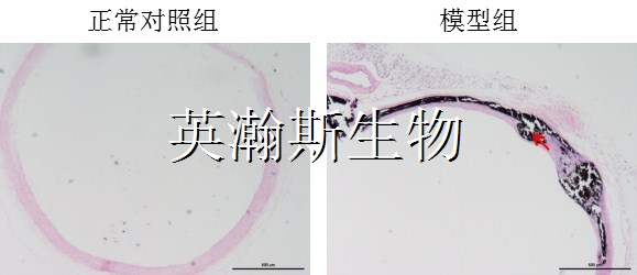 血管钙化模型_wm.jpg